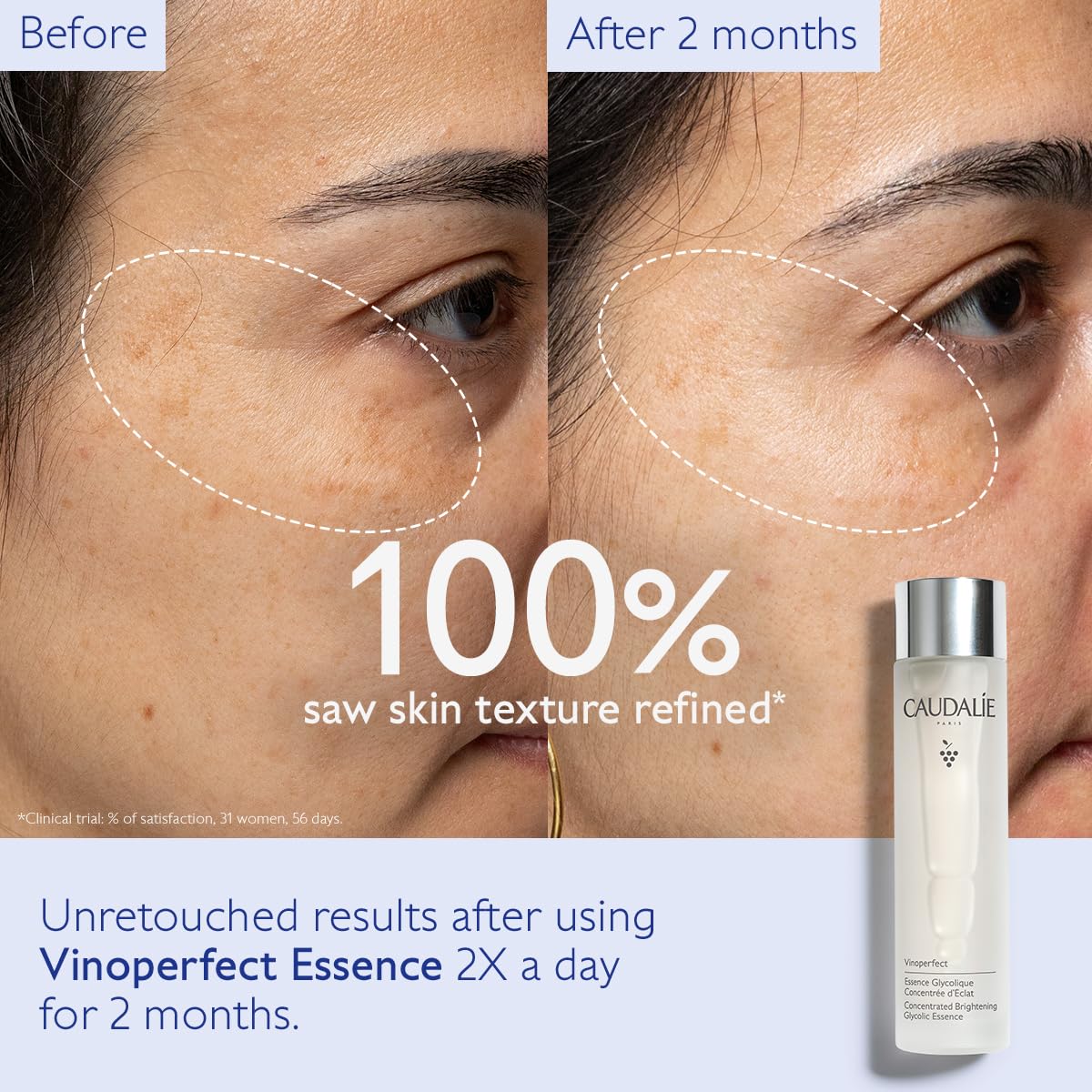 Caudalie Vinoperfect clear essence texture close-up illustrating lightweight absorption