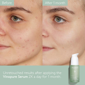 Caudalie Vinopure 30 mL shown beside a coin for size and travel-friendly scale