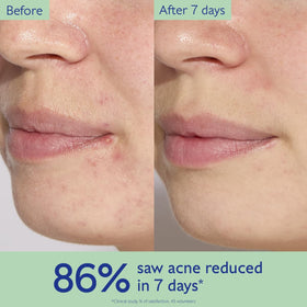 Caudalie Vinopure serum droplet texture demonstrating lightweight absorbency