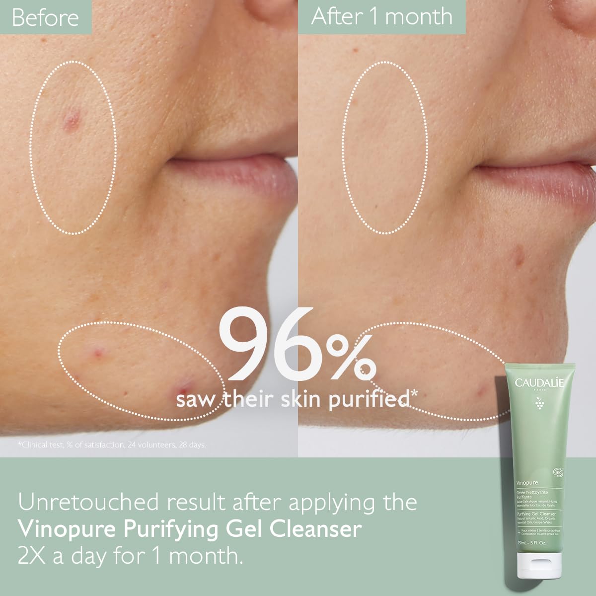 Caudalie Vinopure foam in hand demonstrating gentle cleansing action