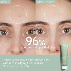 Caudalie Vinopure gel texture closeup showing lightweight consistency