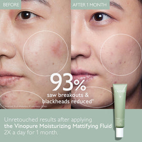Caudalie Vinopure open jar revealing smooth gel for quick absorption