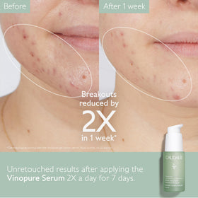 Caudalie Vinopure serum texture close-up showing lightweight, fast-absorbing finish