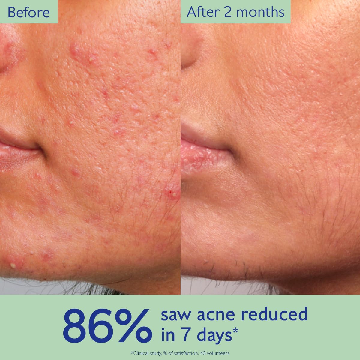 Caudalie Vinopure serum texture drop on fingertip demonstrating lightweight absorption