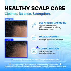 CELDYQUE hand applying roll-on to scalp showing easy targeted use