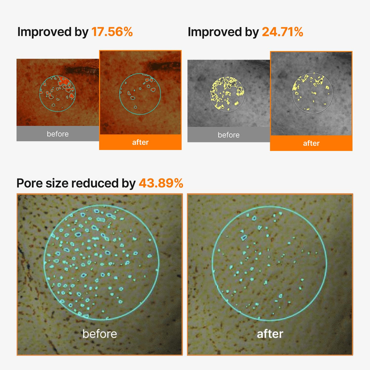 celimax mask applied on face with timer illustrating recommended time