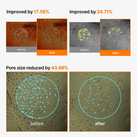 celimax mask applied on face with timer illustrating recommended time