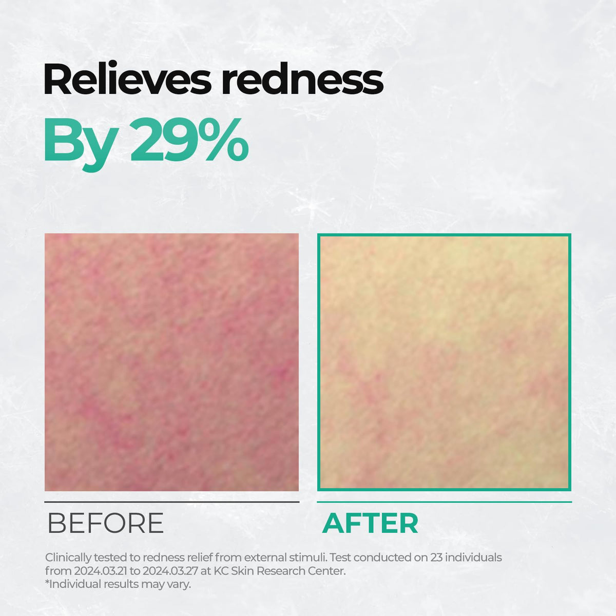 Cell Fusion C pad applied to cheek as mini mask showing targeted calming effect