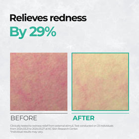 Cell Fusion C pad applied to cheek as mini mask showing targeted calming effect