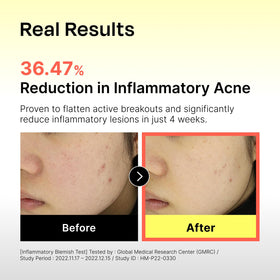 Celladix ampoule label close-up highlighting ceramides and lipid ratio benefit