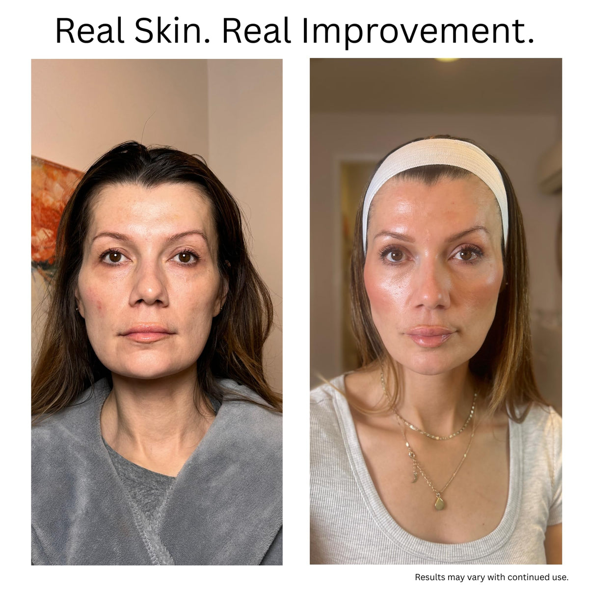 Applying Cellure serum to cheek to show targeted plumping and smoothing benefit