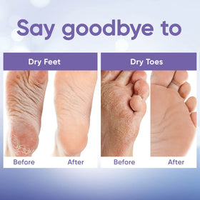 CÉLOR before and after feet comparison, visible softened heels benefit