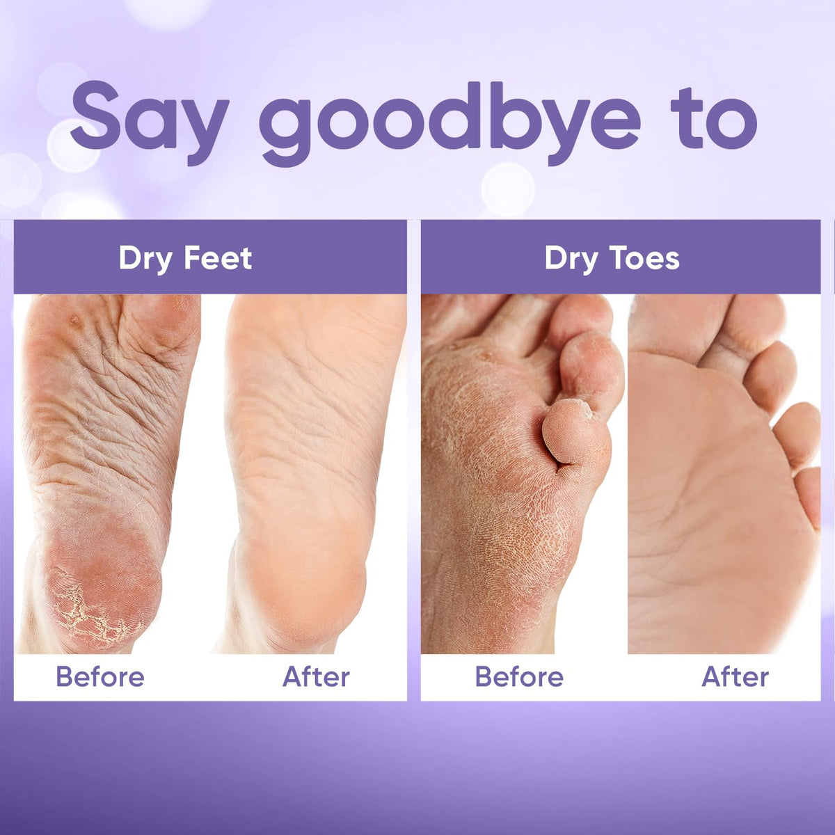 CÉLOR before and after feet comparison showing smoother, softer skin
