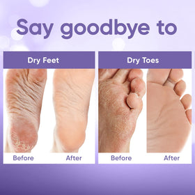 CÉLOR before and after feet comparison showing smoother, softer skin