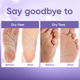 CÉLOR in-use photo of feet wearing booties promoting at-home spa results