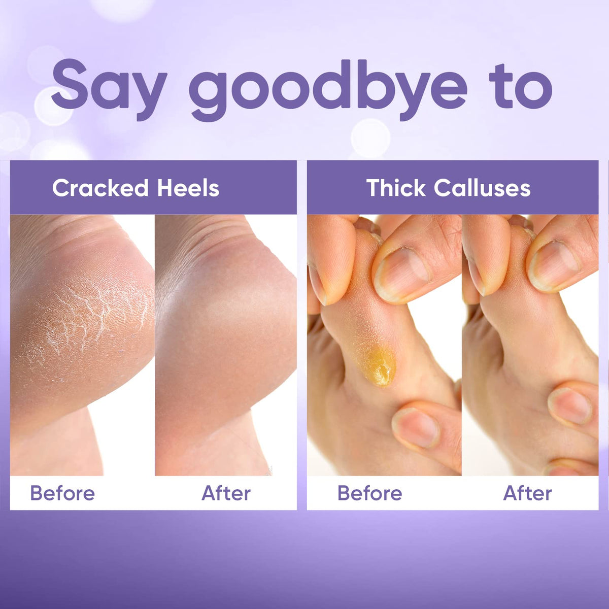 CÉLOR size comparison showing bootie fit and compatibility for most feet