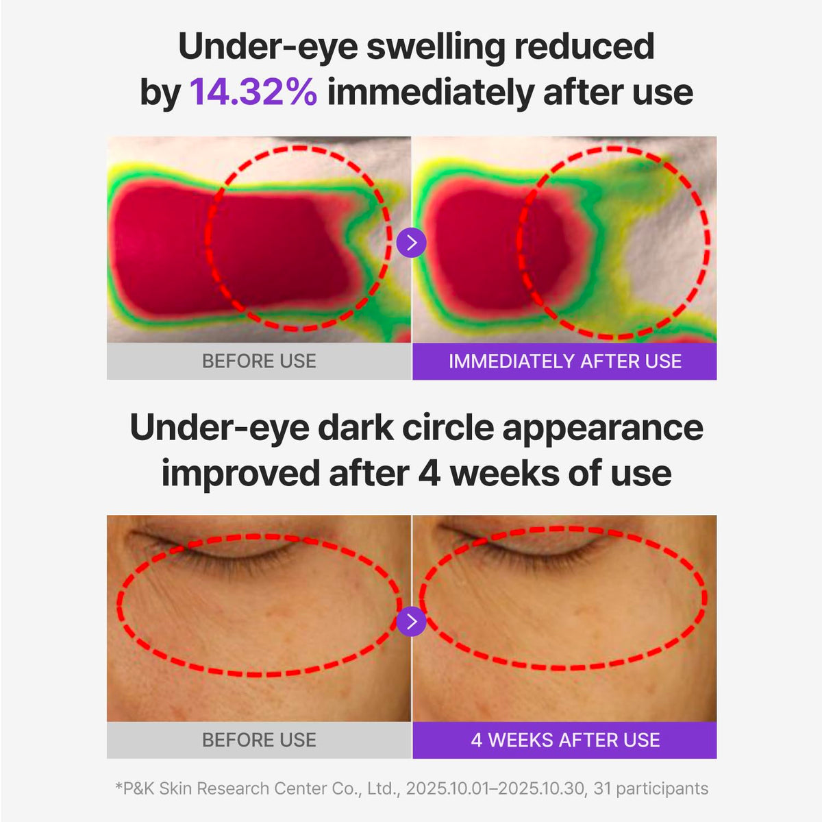 CENTELLIAN 24 patch applied under eye demonstrating cooling fit