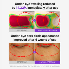 CENTELLIAN 24 patch applied under eye demonstrating cooling fit