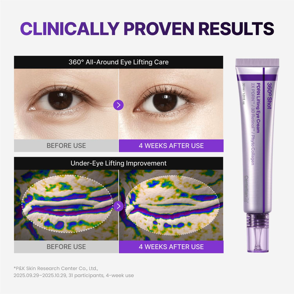 CENTELLIAN 24 hydrogel eye patches applied under eyes providing cooling refresh