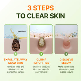 CENTELLIAN 24 used on elbow showing body exfoliation and texture improvement
