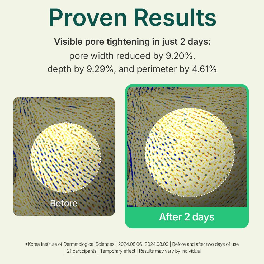 CENTELLIAN 24 applied as a spot treatment on cheek to visibly calm blemishes and control shine