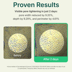 CENTELLIAN 24 applied as a spot treatment on cheek to visibly calm blemishes and control shine