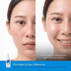 Ceramedx applied to face demonstrating soothing hydration benefit