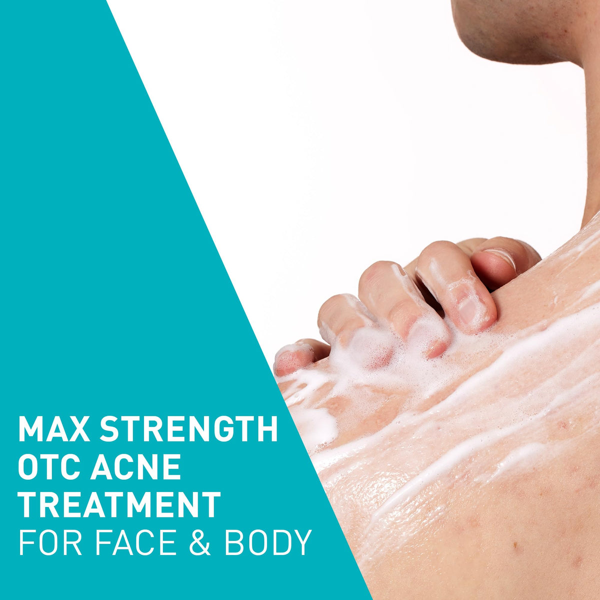CeraVe ingredient label highlighting 10% benzoyl peroxide for acne control