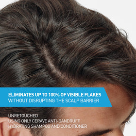 CeraVe shampoo bottle label close-up highlighting pyrithione zinc treatment benefit
