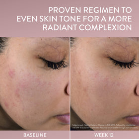 Applying Cetaphil serum to face demonstrating gentleness and hydration