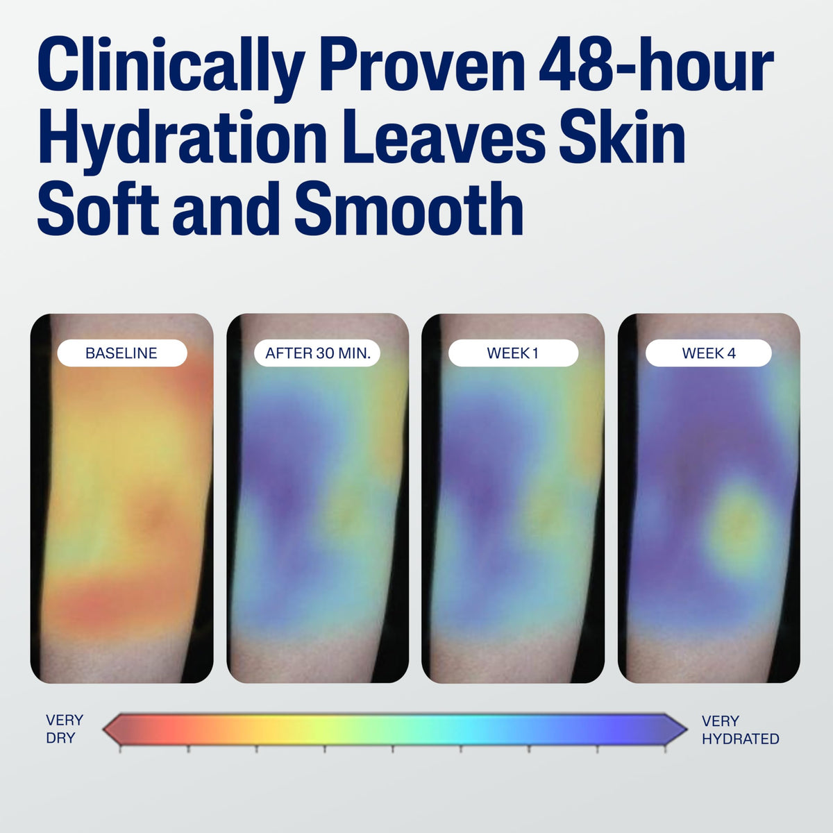 Cetaphil being applied to elbow to soothe and hydrate dry areas
