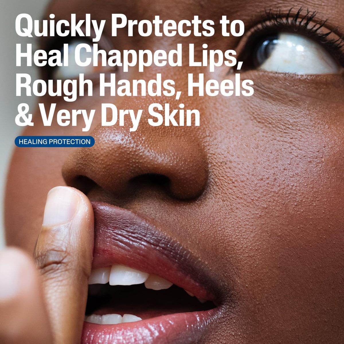 Cetaphil healing ointment ingredients shot highlights shea butter and vitamin E benefit
