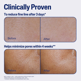 Cetaphil serum on fingertip absorbing into skin to show rapid hydration and non‑sticky finish