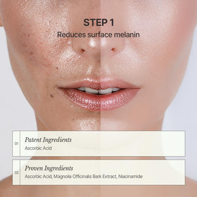CHALLANS DE ampoule in hand demonstrating compact size and easy application benefit