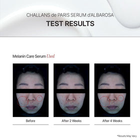 CHALLANS DE packaging and box presentation conveying premium Korean skincare benefit