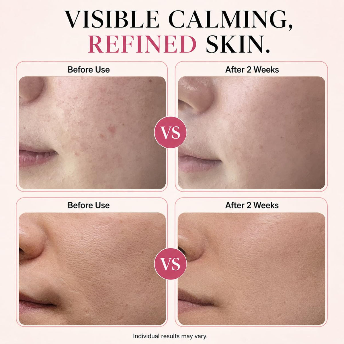 CHALTTOK label close-up listing hyaluronic acid and niacinamide benefits