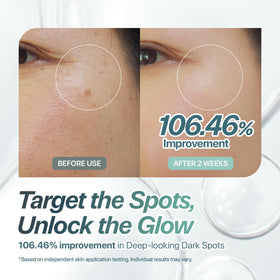 CHARDE Snow Ampoule applied to cheek demonstrating targeted spot care