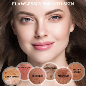 CHEOKINGBA niacinamide and vitamin C ingredients display supporting brightening