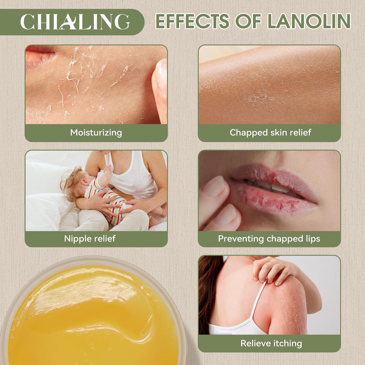 Chialing rubbed into hands and knuckles for deep moisturizing