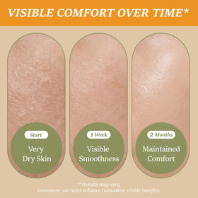 ChiroLife balm used on lips and chin highlighting targeted hydration