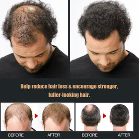 CIDBEST lifestyle shot with man and woman using shampoo for thicker-looking hair