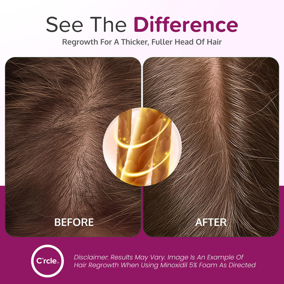 C'rcle being applied to crown to target top-of-scalp thinning benefit