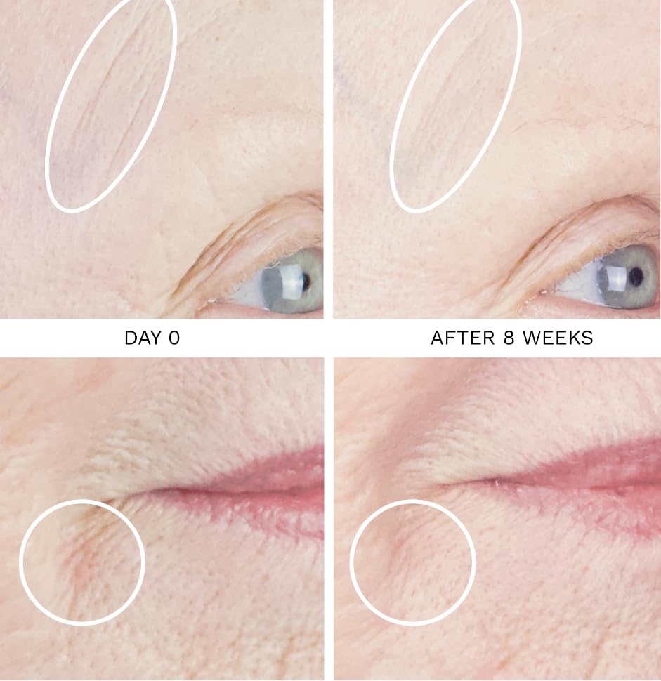 City Beauty pipette dispensing serum for precise application