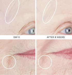 City Beauty pipette dispensing serum for precise application