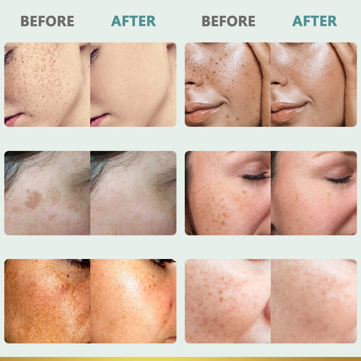 CITYGOO before and after comparison illustrating improved tone and reduced spots