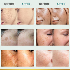 CITYGOO before and after comparison illustrating improved tone and reduced spots