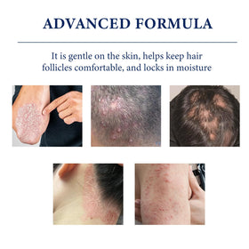 CJMJIM used as a scalp spot treatment to soothe bumps and hydrate follicles
