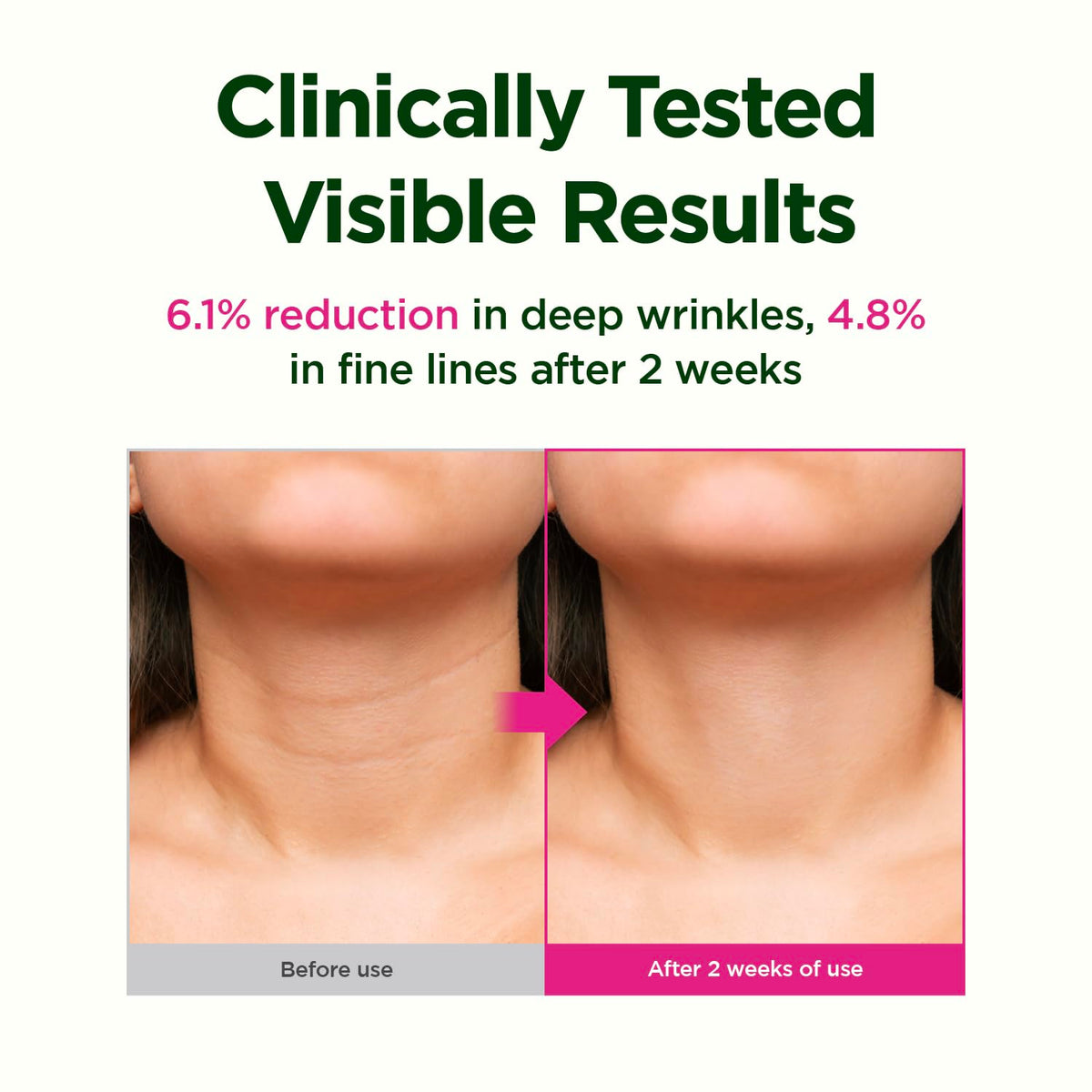 CKD Guaranteed applying cream to neck and jawline for firmer look