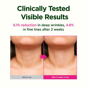 CKD Guaranteed applying cream to neck and jawline for firmer look