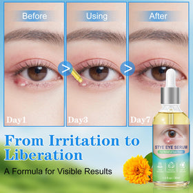 clabay application on lashline demonstrating easy use and focused relief
